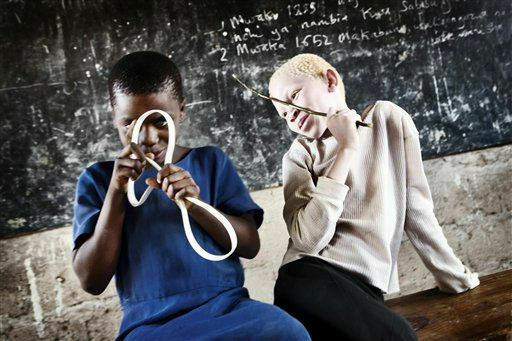 Смертельное суеверие: Девочка-альбинос в Черной Африке