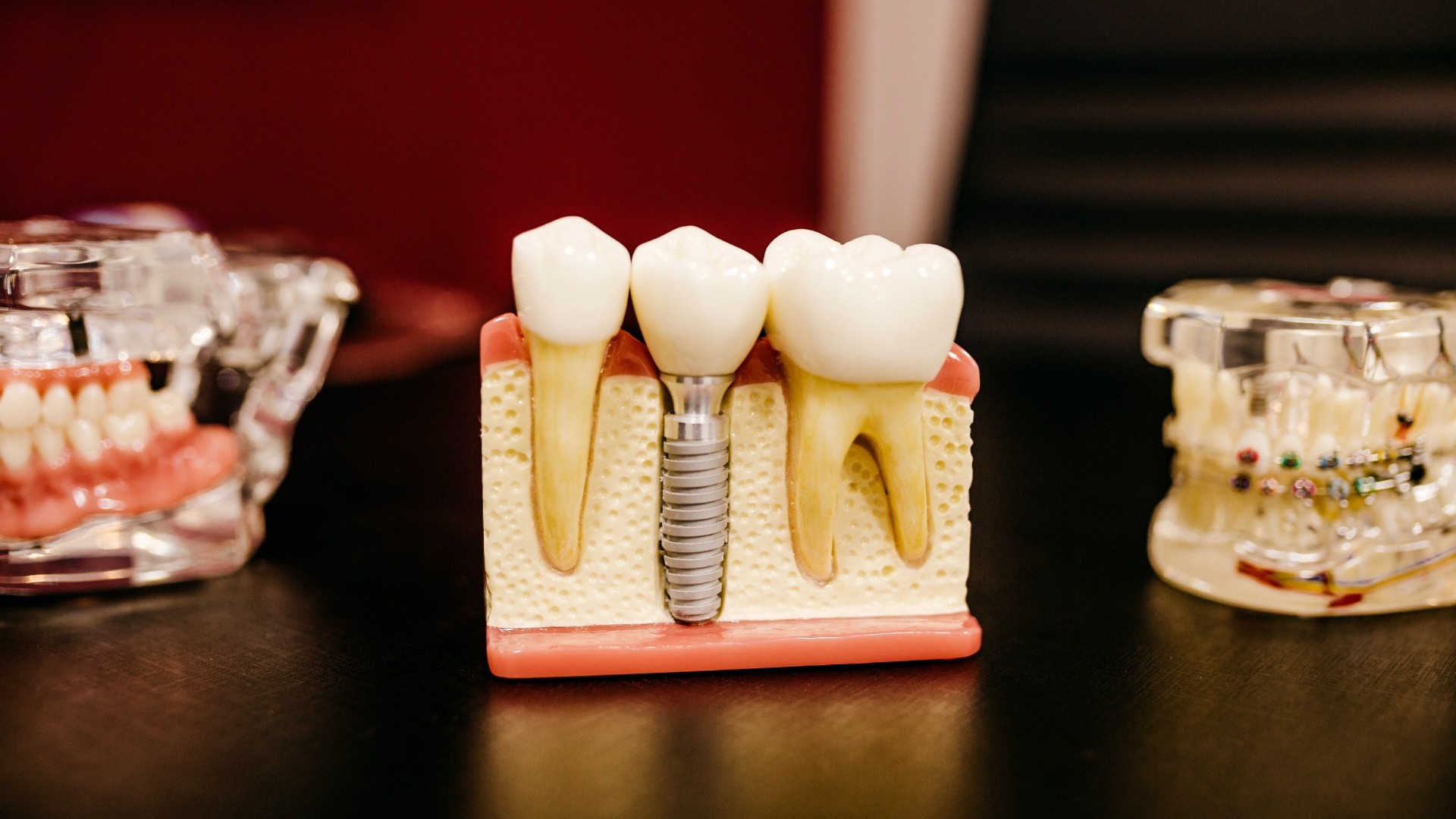 Стоматолог перечислила привычки, которые способны разрушить зубы