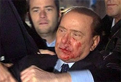 Премьер Берлускони потерял зуб и кровь за правое дело (ВИДЕО)