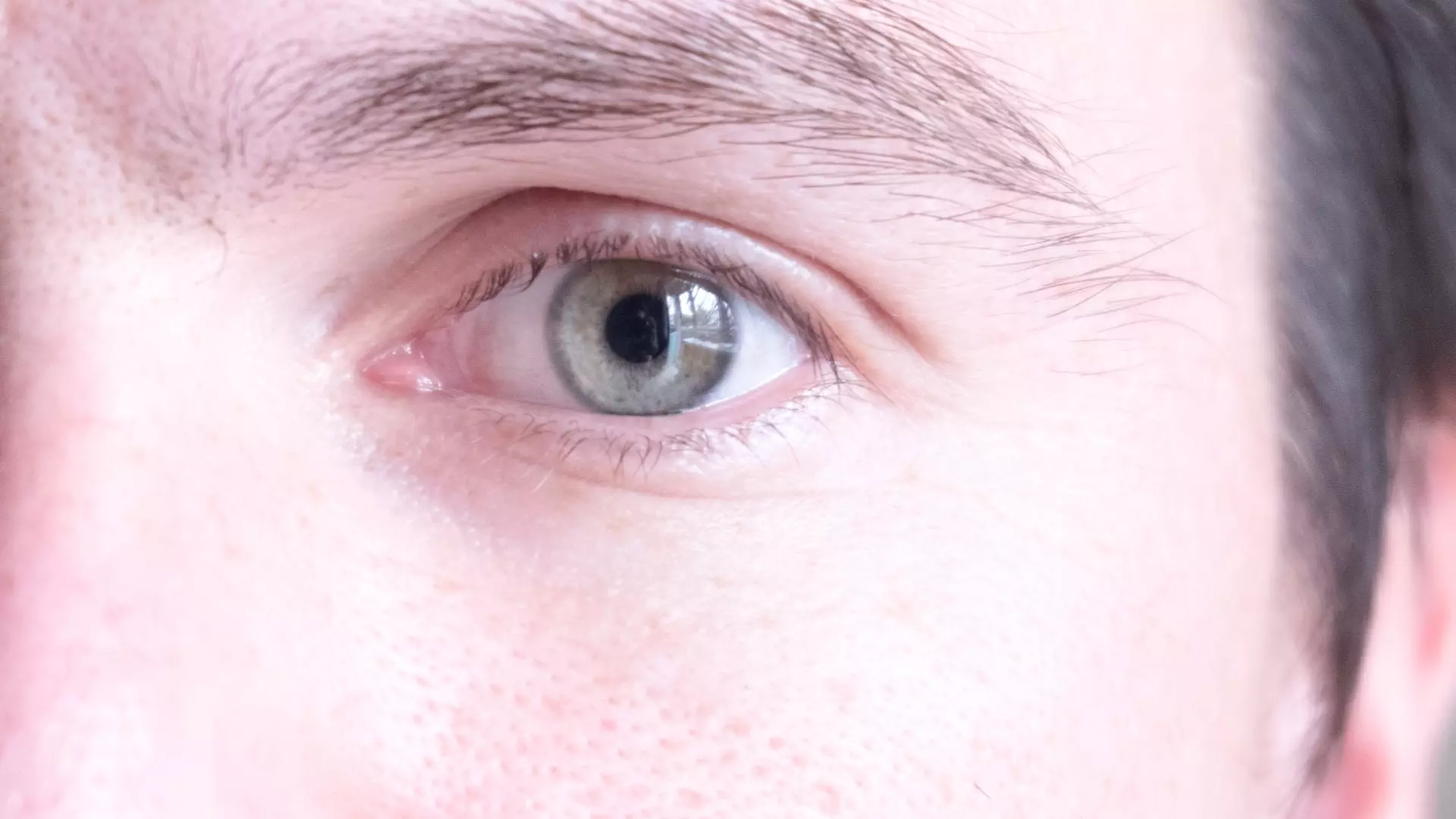 Офтальмологи объяснили, о чем на самом деле говорят «красные глаза» на фото