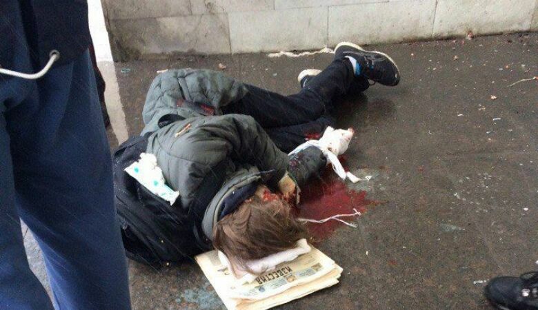 В Петербурге - опять взрыв. Подростку оторвало руку