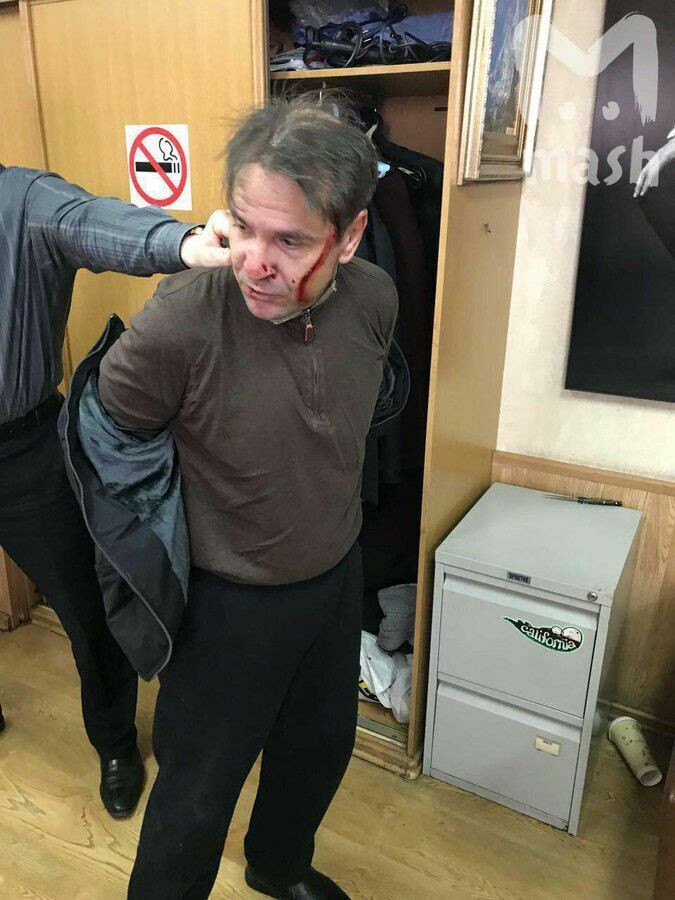 Следствие потребует в суде арестовать напавшего на журналистку "Эха Москвы"