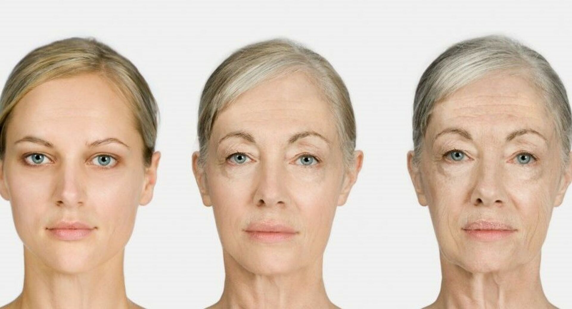 Изменения после 30. Возрастные изменения кожи. Возрастные изменения кожи лица. Возрастные изменения человека. Старение лица.