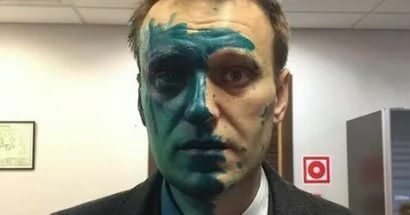 Алексей Навальный будет неделю лечиться за границей