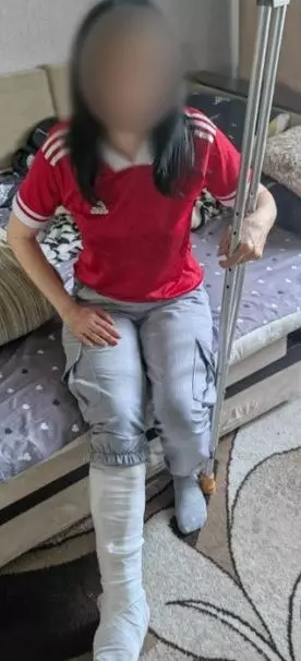 В результате нападения у супруги ветерана СВО сломана нога