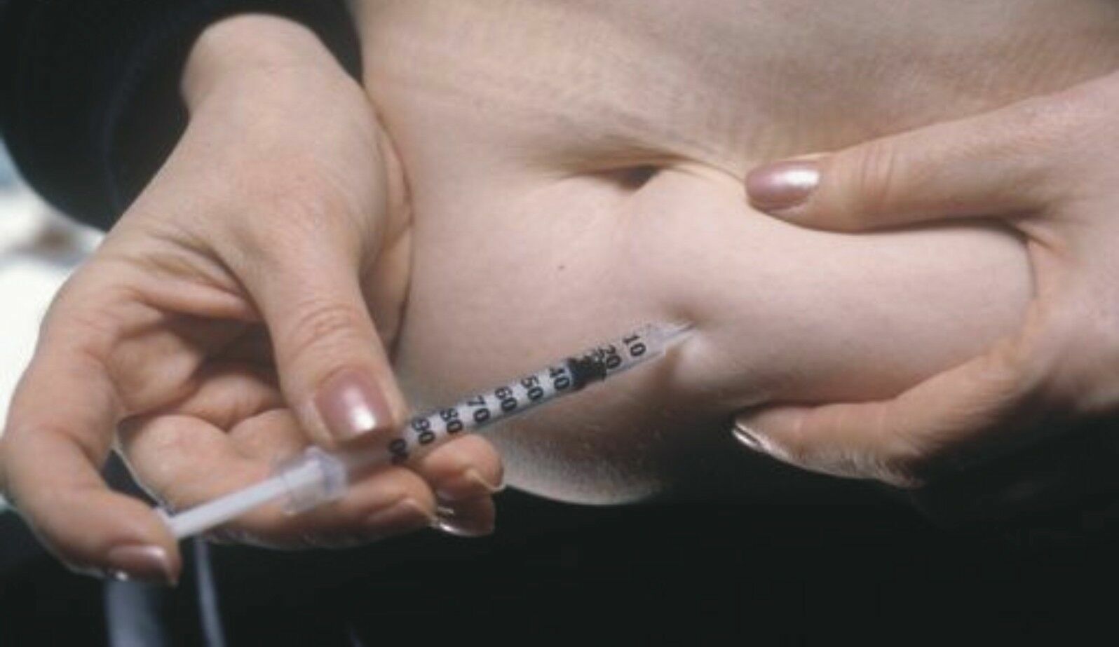 Вместо инсулина: суд Саратова признал организацию диабетиков иноагентом