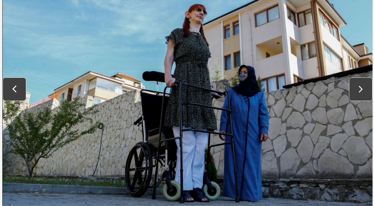 24-летнюю турчанку признали самой высокой женщиной в мире