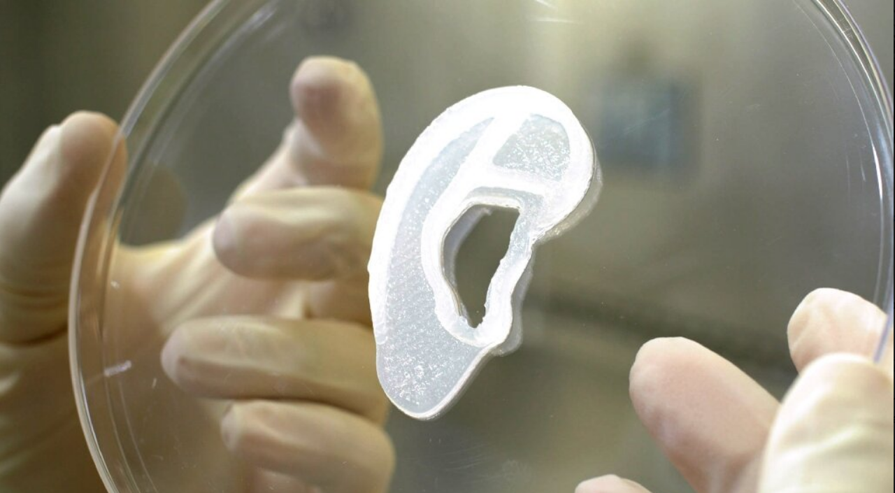 Хирурги пересадили 3D-ухо, выращенное из живых клеток