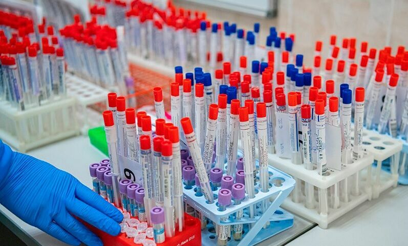 В частных лабораториях антитела к коронавирусу обнаружили у 14% россиян