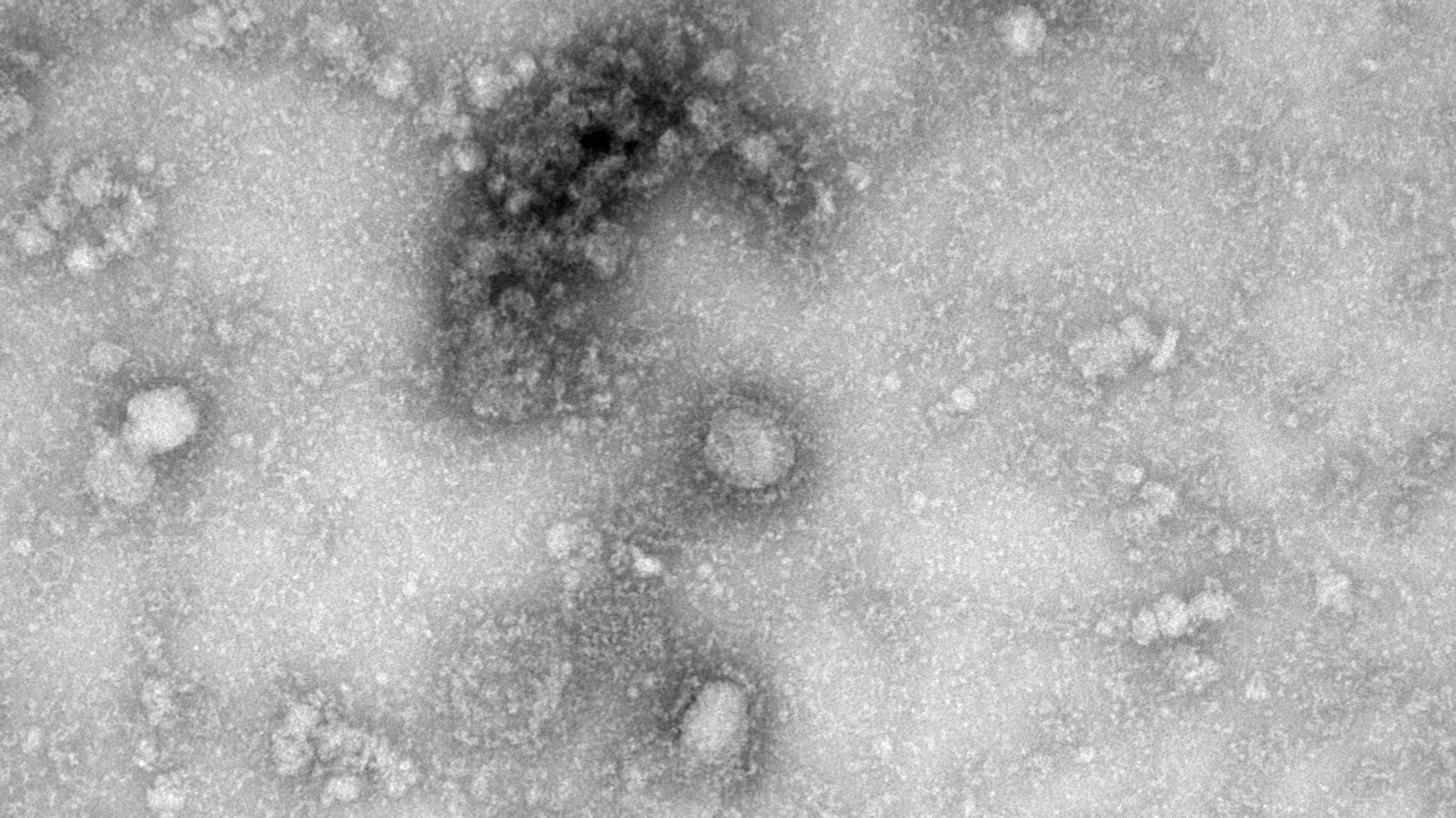 «Все непонятное – страшно»: инфекционист рассказал о странностях коронавируса