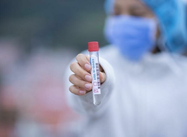 Ведущий инфекционист США: вакцину от коронавируса создадут к концу года