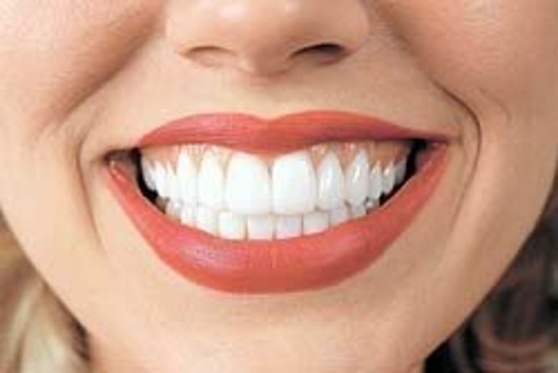 Видны передние зубы. Голливудская улыбка виниры. Красивые зубы. Красивые ровные зубы. Разноцветные зубы.