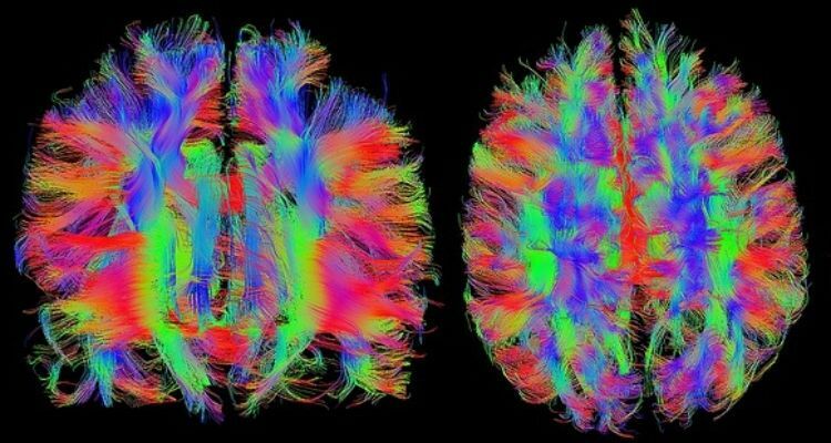 Ученые выяснили, как уменьшить опухоль мозга