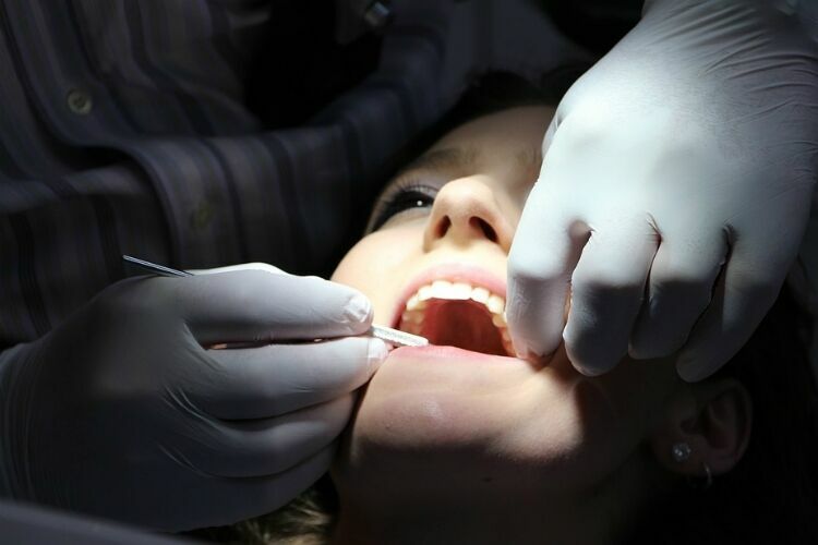 Ученые: Здоровье зубов влияет на память человека