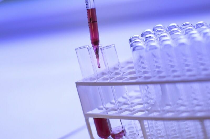 Минздрав прокомментировал отсутствие тестов на COVID для онкобольных в Перми