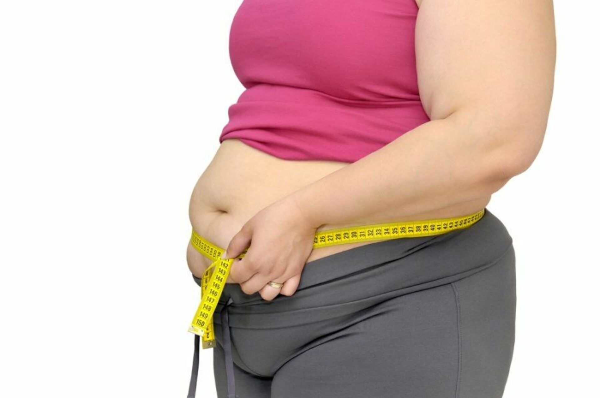 Тело толстой женщины. Ожирение. Лишний вес. Избыточный вес.