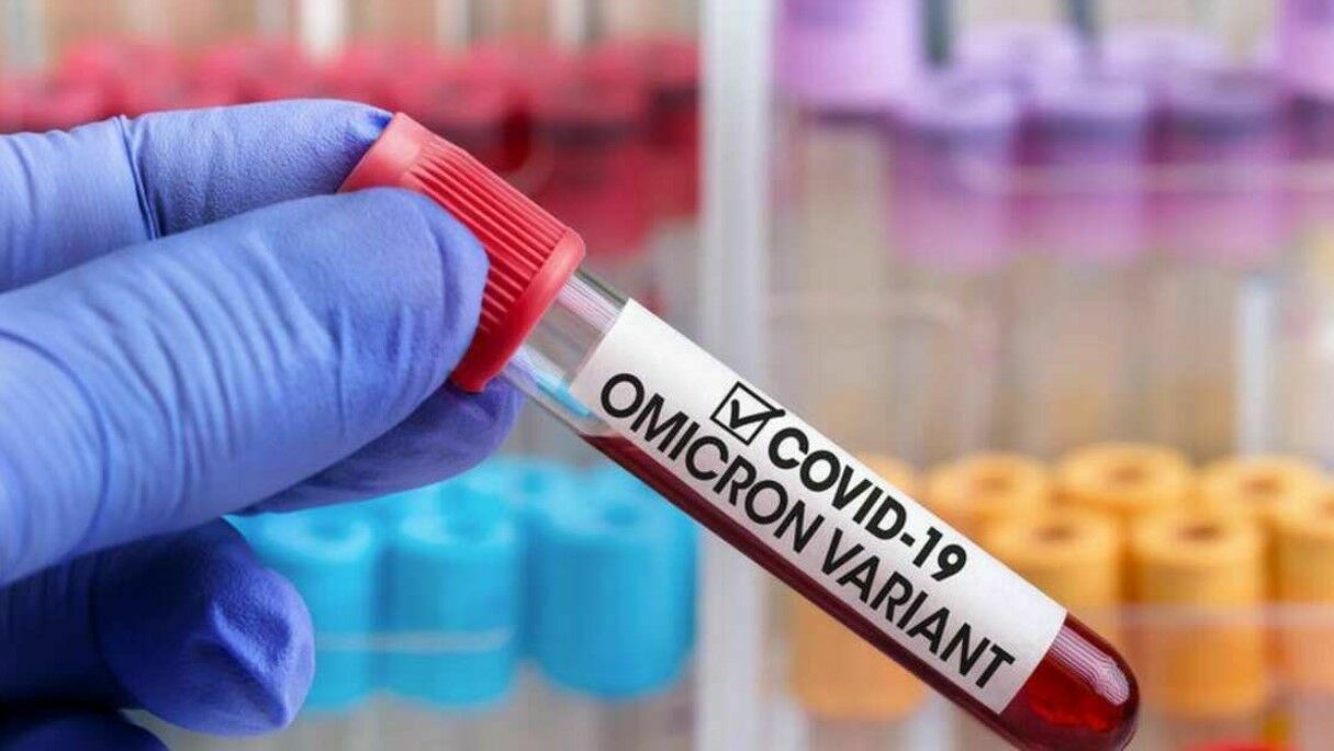 Медики ЮАР считают, что поведение «Омикрона» может говорить о выходе из пандемии
