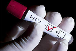 Слухи о  ВИЧ-эпидемии преувеличены
