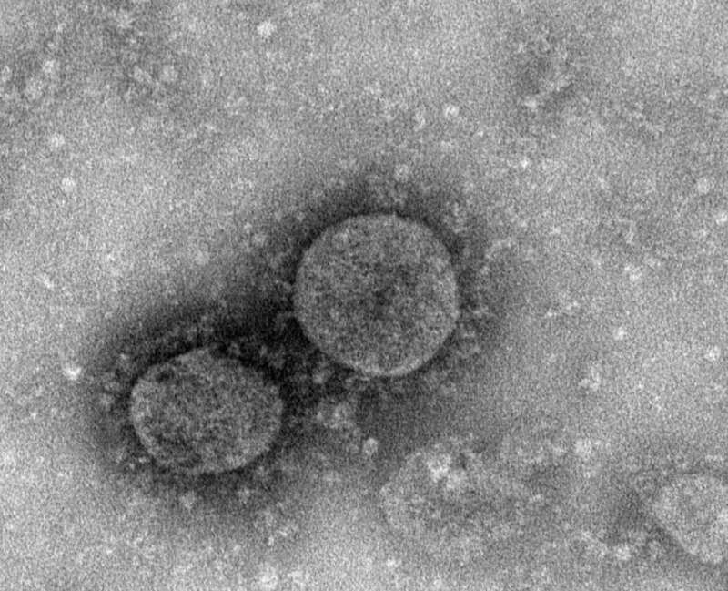 Ученые определили температуру гибели коронавируса