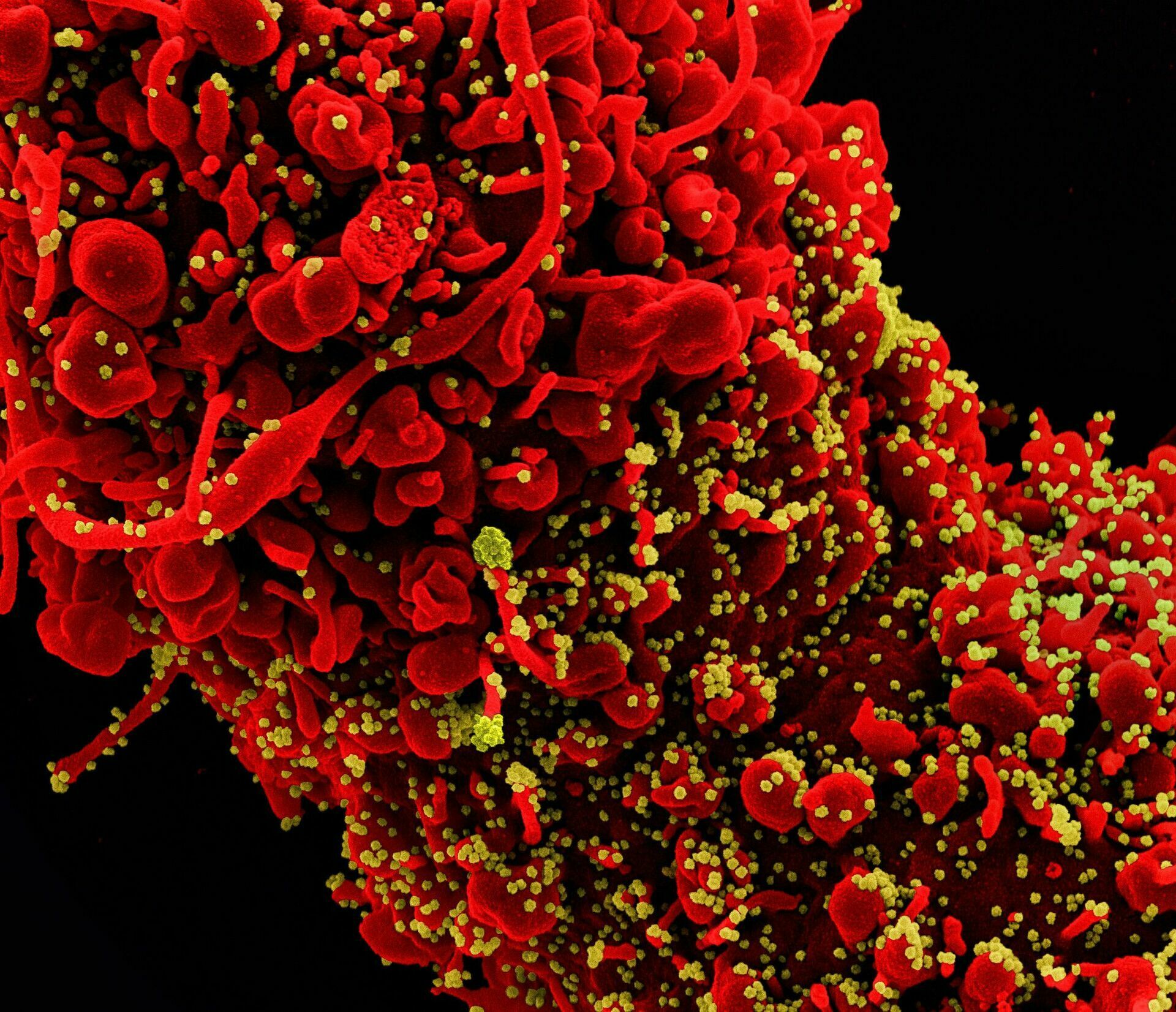 Почему коронавирус стал поражать быстрее, и что с этим делать: мнение биолога
