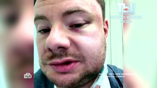 Пермский депутат получил два года колонии за избиение DJ Smash