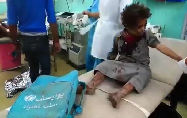 В Йемене погибло 30 детей в результате обстрела школьного автобуса