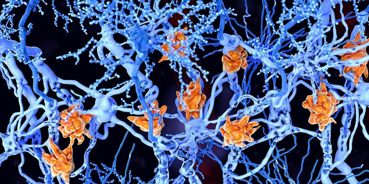 Гарвардские исследователи назвали главную причину рассеянного склероза