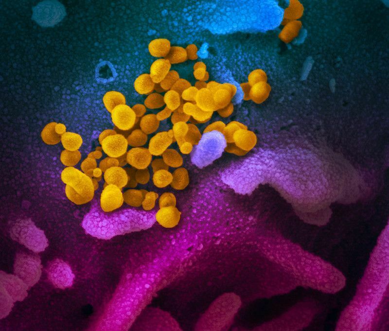 Найти и обезвредить: ученые показали, как выглядит новый коронавирус