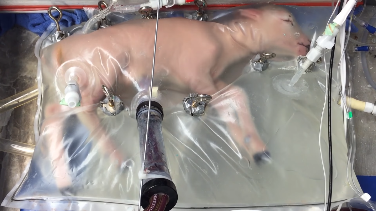 Ученые создадут искусственную матку для недоношенных детей