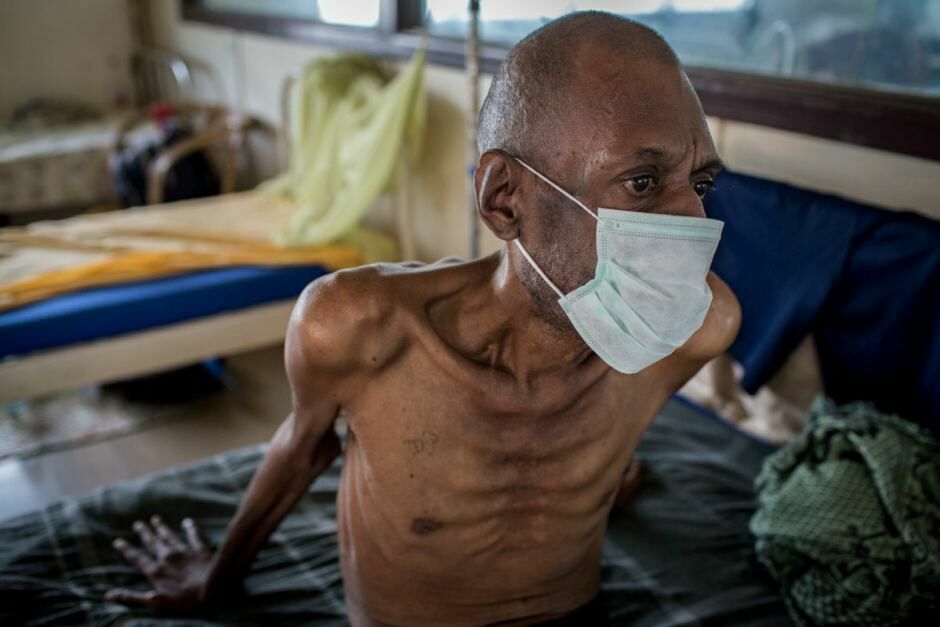 ВОЗ: туберкулёз угрожает каждому четвёртому жителю планеты