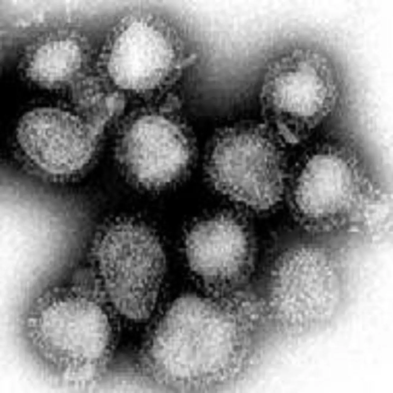 Так выглядят вирусы гриппа, вызвавшие гонконгский грипп (увеличение примерно в 100 тыс. раз)