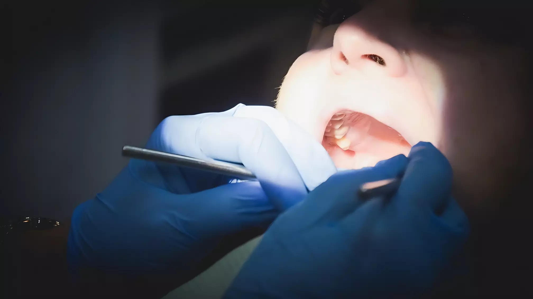 Зубы по цене «однушки»: о чем нужно знать, прежде чем идти к стоматологу