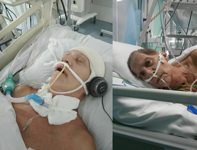 После ДТП Ольга Ларина 2 недели находилась в коме, потом езе 2 недели без сознания. Вместе с гематомой была удалена часть мозга женщины. Фото Е.Лариной.