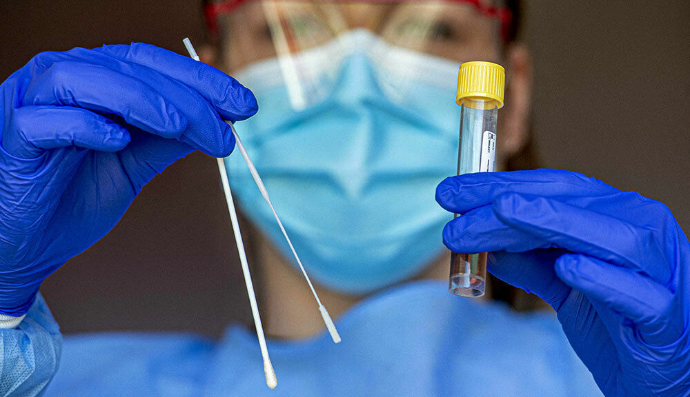 Ученые подтвердили: тест на антитела может не выявлять коронавирус