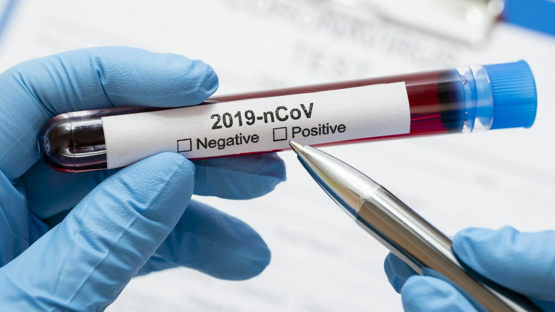 "Инвитро": тесты на коронавирус теперь можно сделать самому и не выходя из дома