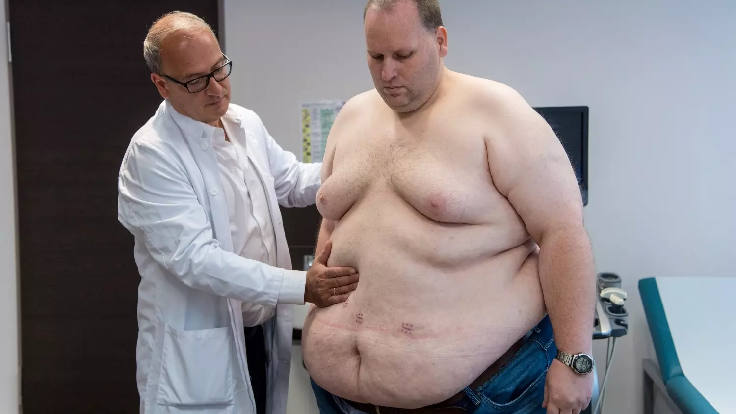 Дополнительный признак ожирения — окружность талии свыше 94 см у мужчин и 80 см у женщин
