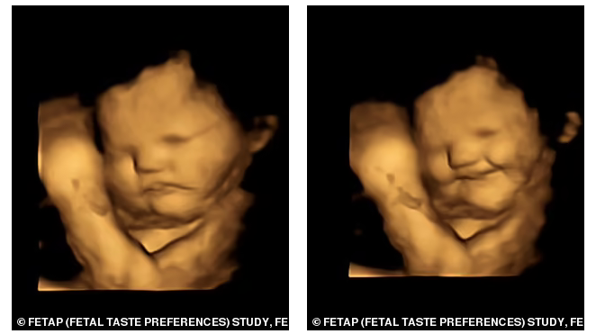 Дети в материнской утробе реагируют на вкусы и запахи, показало УЗ-сканирование