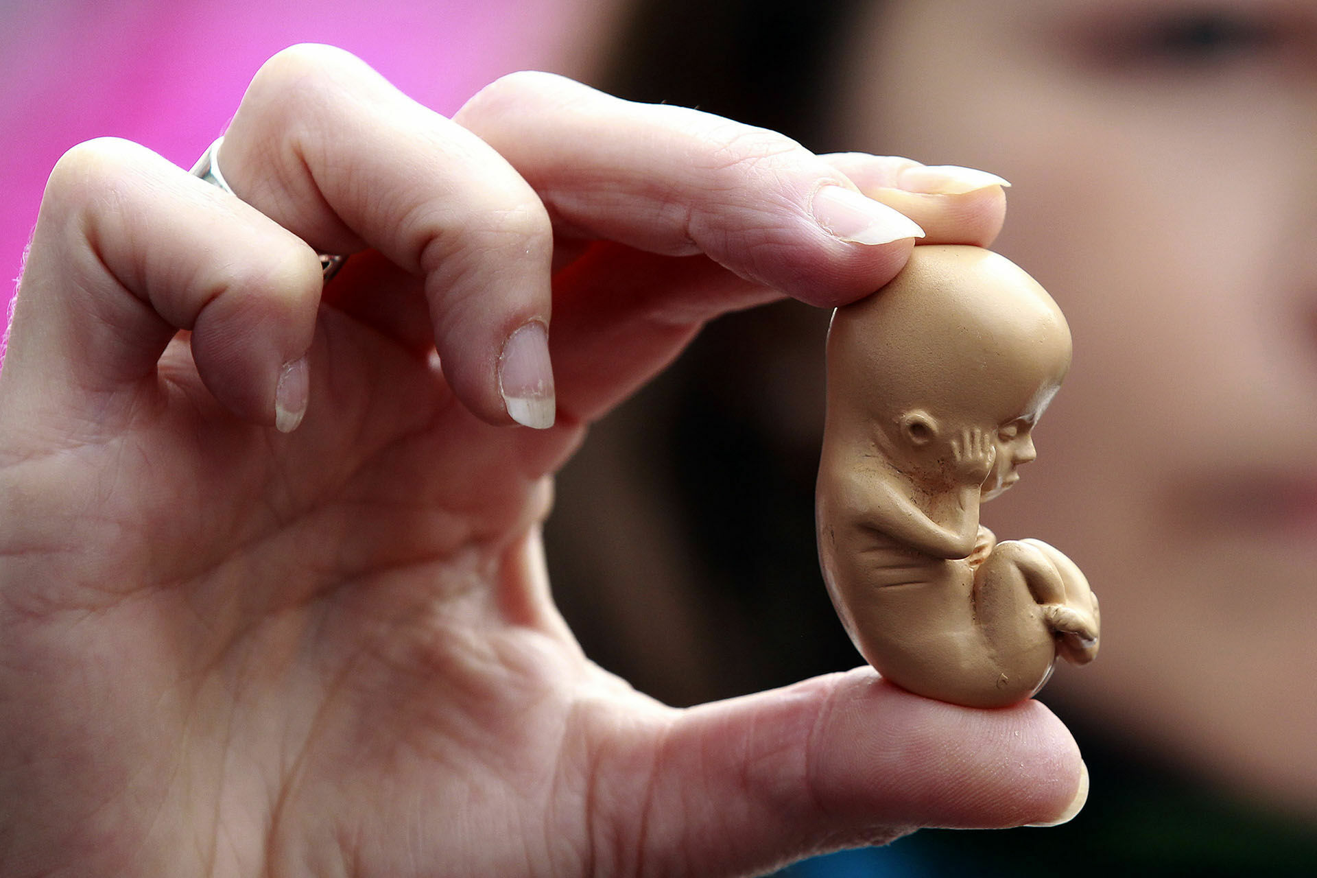 Вопрос дня: помогут ли платные аборты повысить рождаемость и снизить преступность?