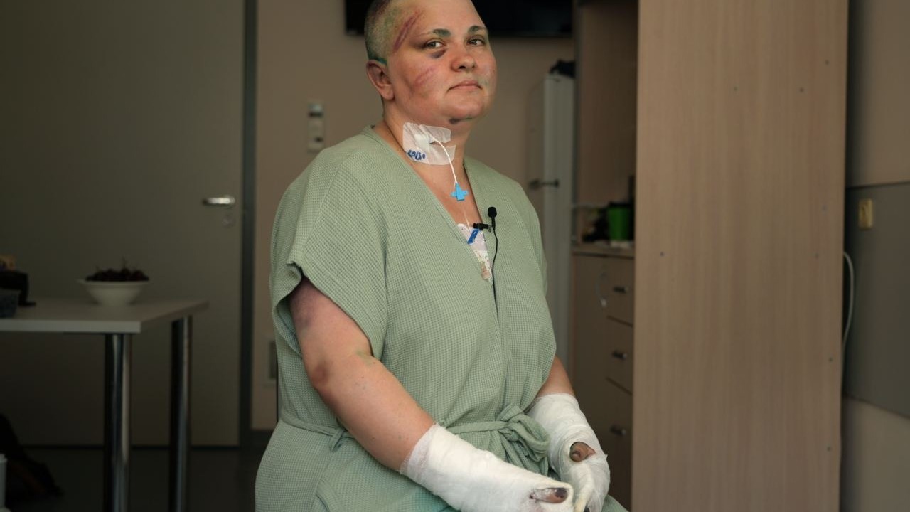 Елена Милашина после нападения в Чечне.