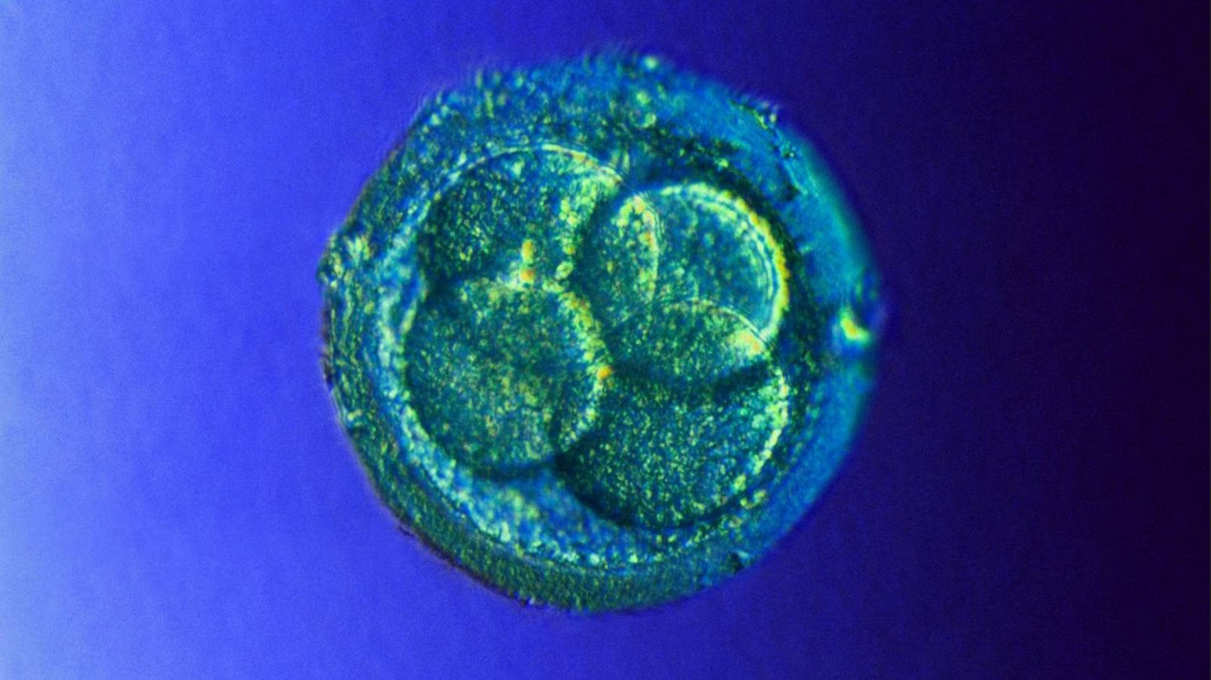 А так выглядит человеческий эмбрион