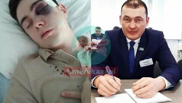 В Татарстане на экс-чиновника завели дело об избиении журналиста