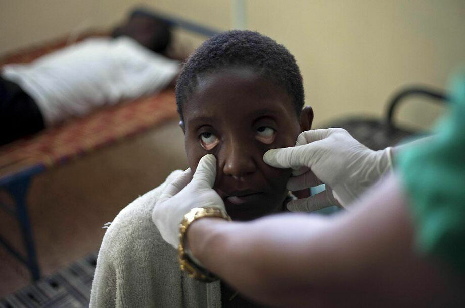 Al Jazeera: на Гаити ООН зафиксировала вспышку холеры