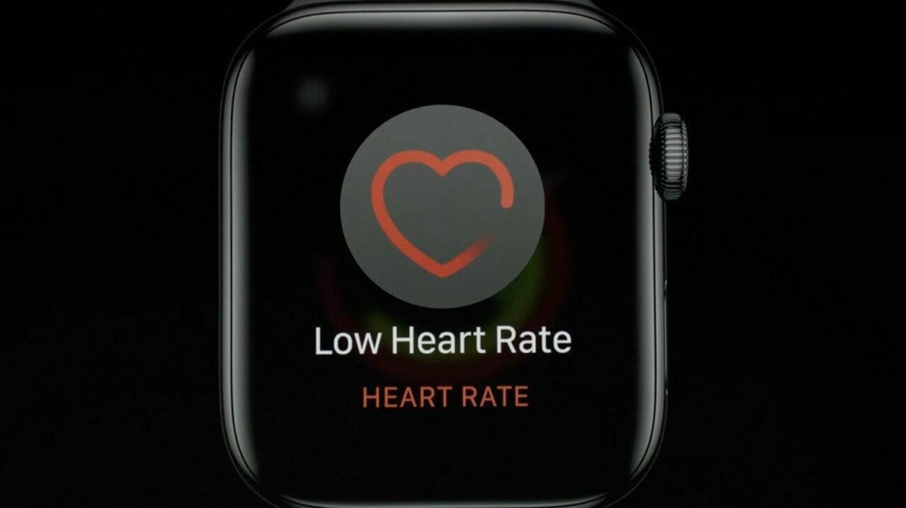 Если вдруг ваши Apple Watch Series 4 заметят, что пульс слишком низкий, они посоветуют обратиться к врачу. И даже покажут электрокардиограмму!