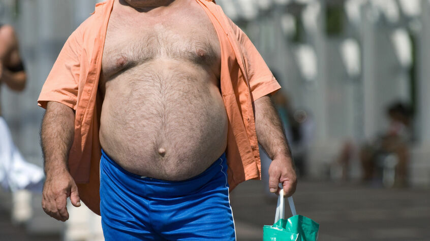 Ученые подсчитали убытки от ожирения