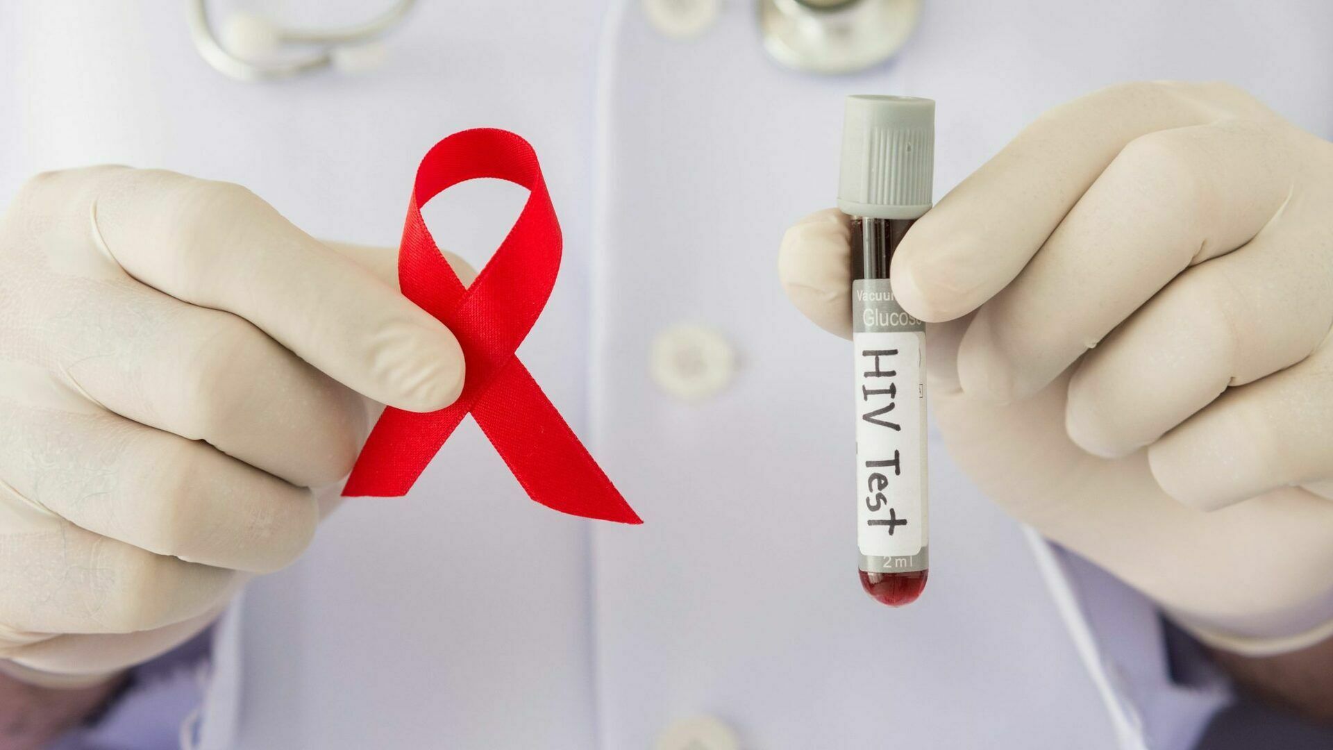 Россия вошла в пятерку стран по скорости распространения ВИЧ