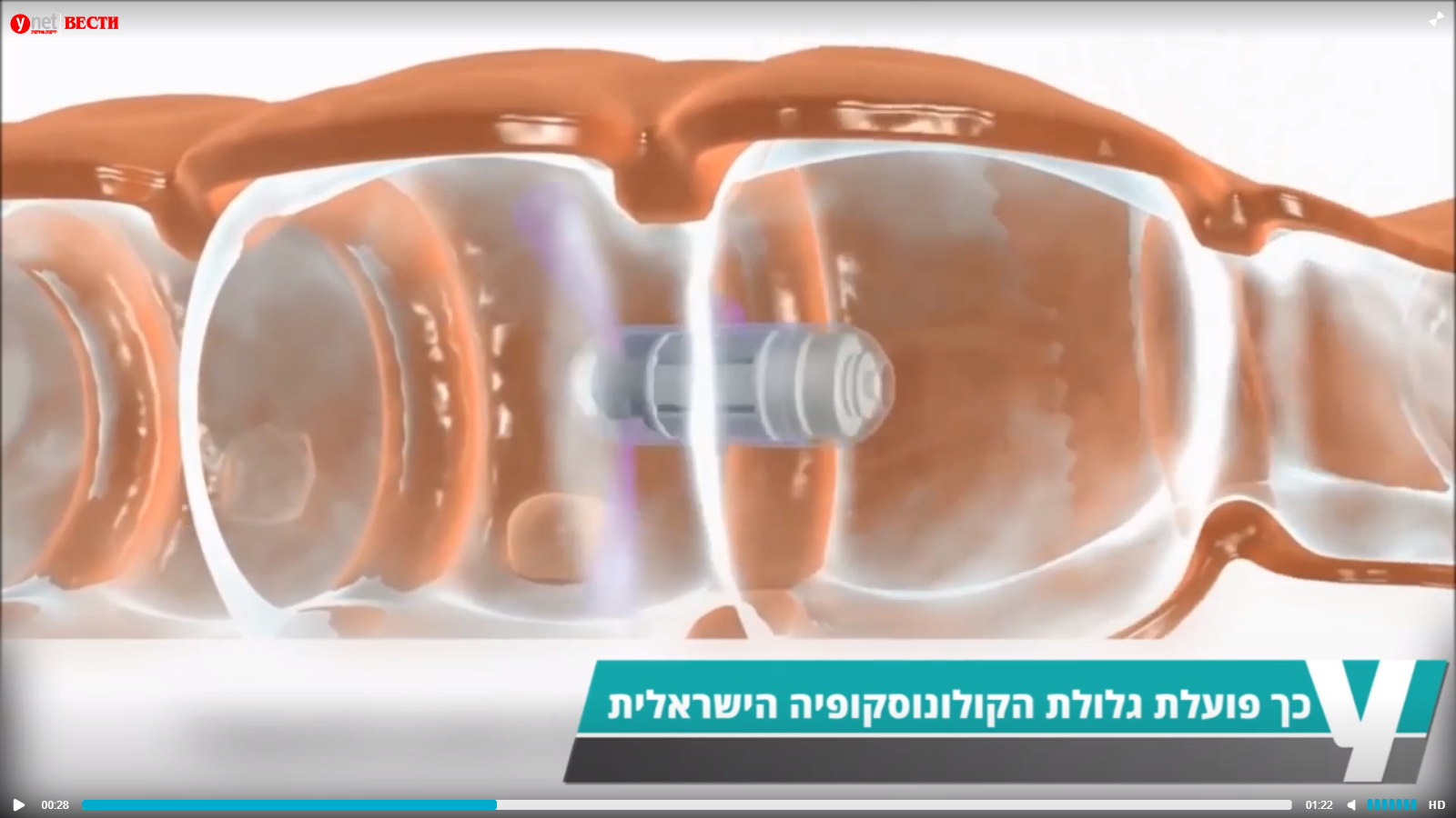 Теперь без мук: в Израиле изобрели миникамеру для диагностики кишечника