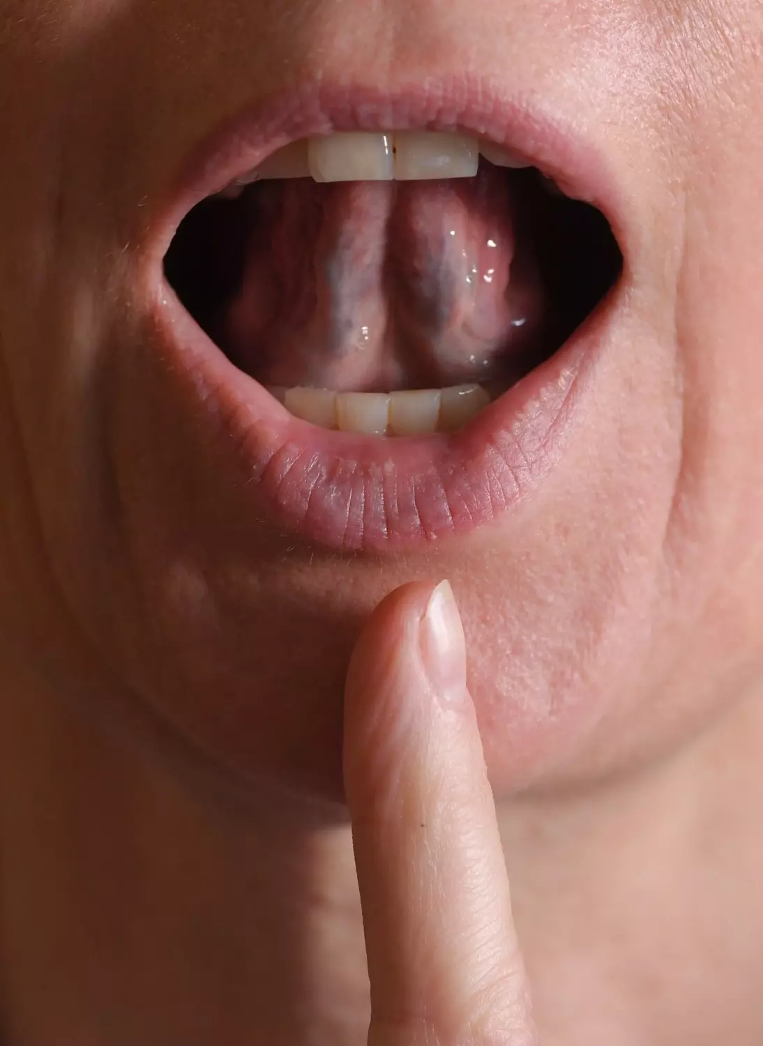 В некоторых случаях «зубчатый» язык может быть следствием недостаточного количества воды в организме