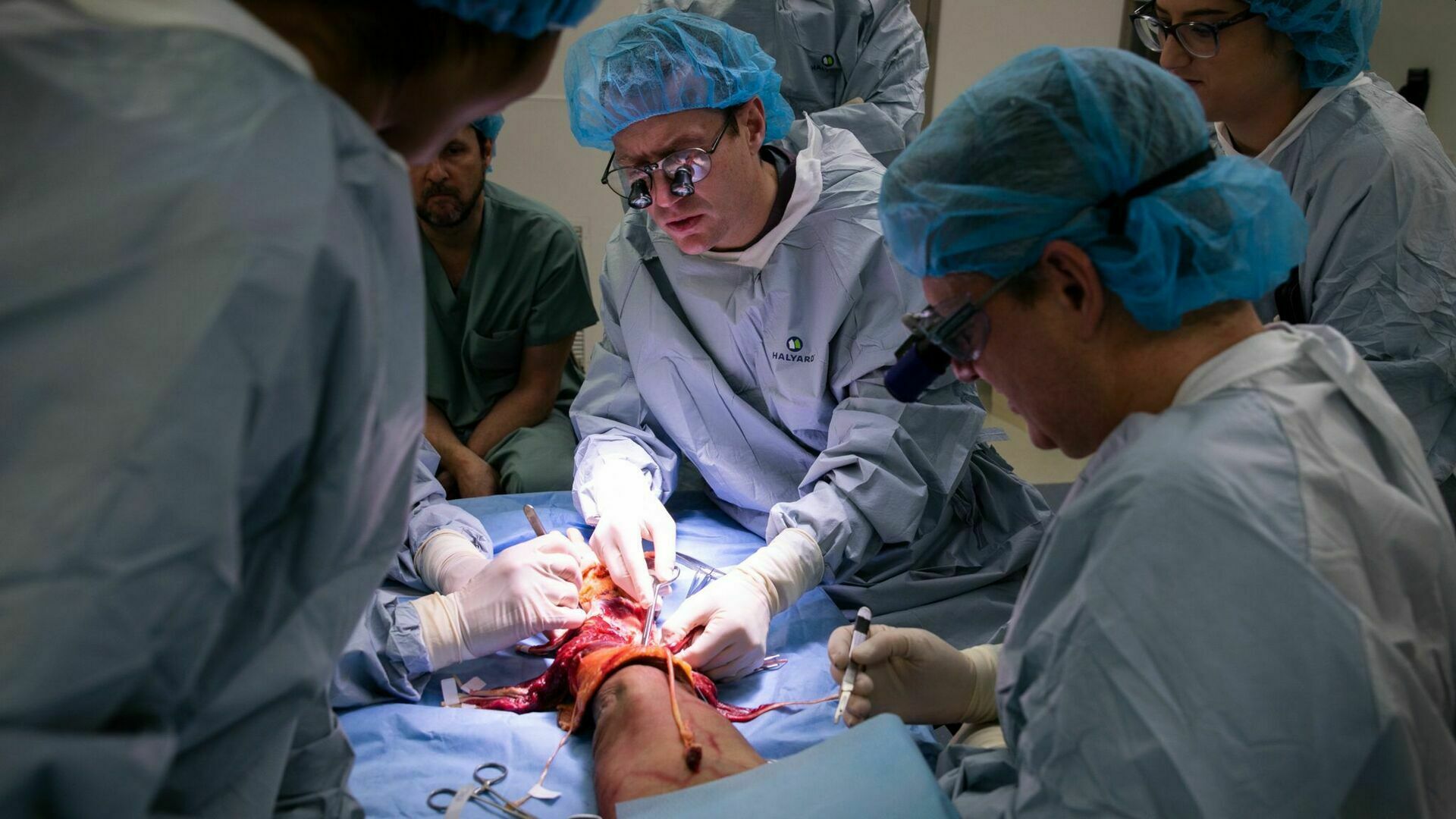 Австрийского хирурга оштрафовали на 2700 евро за ампутацию не той ноги