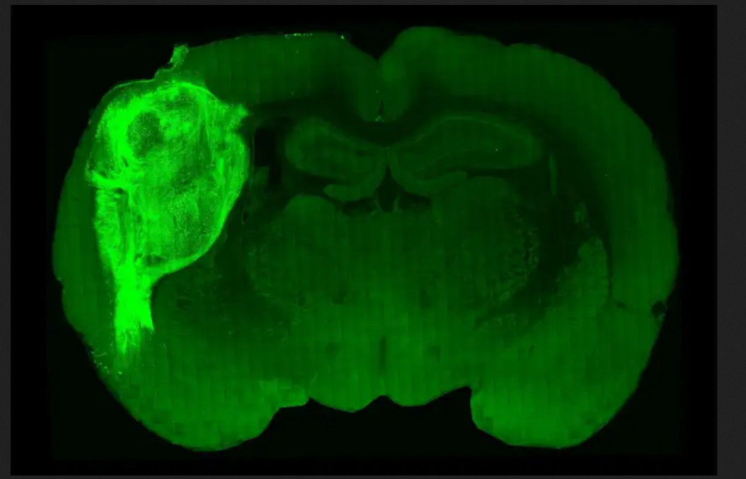 Человеческие нейроны удалось пересадить в мозг новорожденных крысят