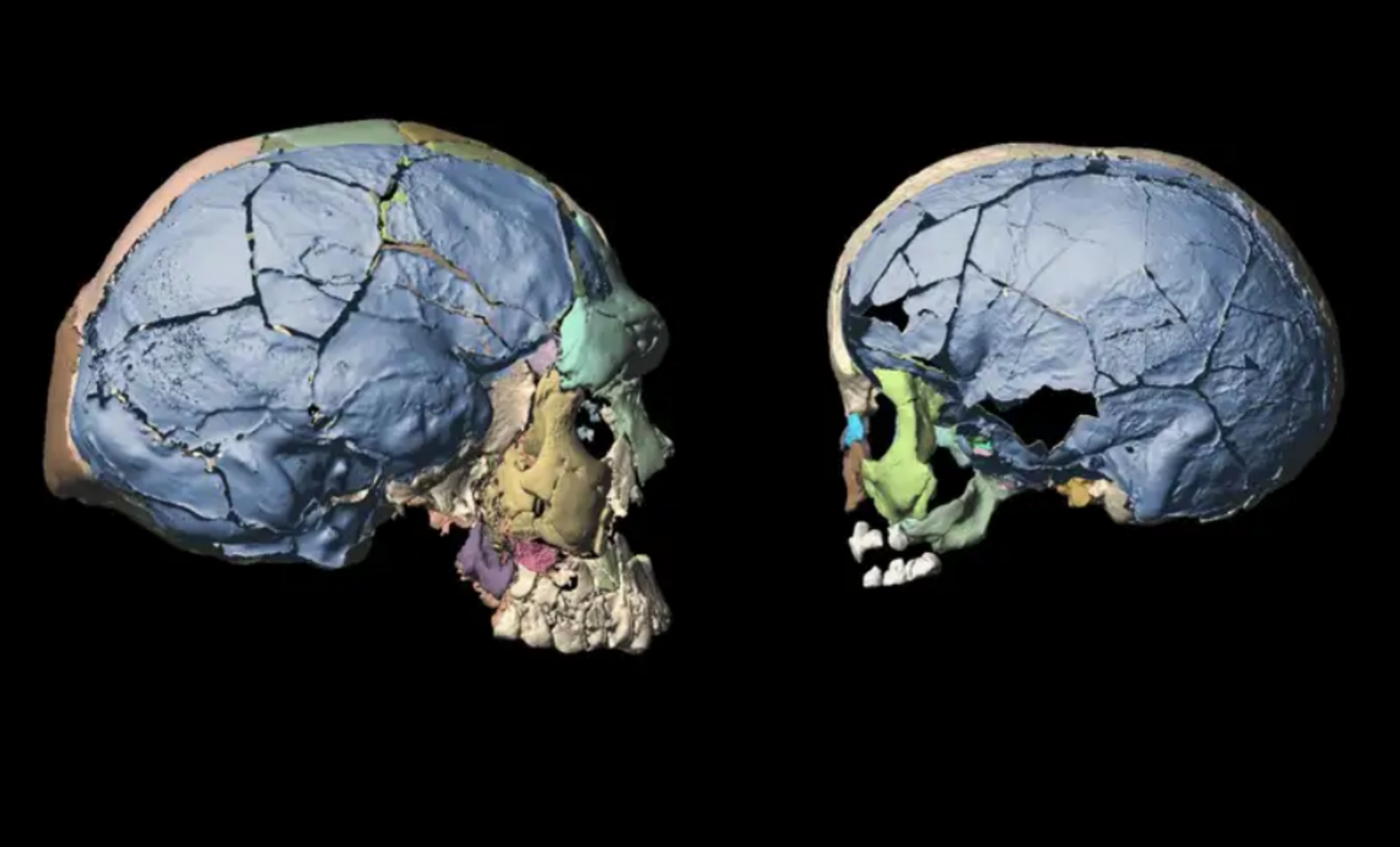 Органическое изменение мозга. Эволюция черепа человека. Исследование мозга. Череп современного человека.